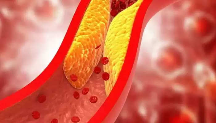 How To Control Cholesterol  