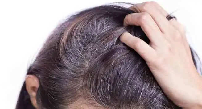 Home Remedies For White Hair